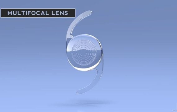 Refractive Lens Exchange - 45 years +