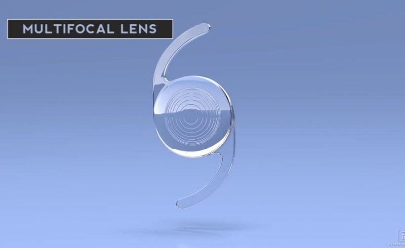 Refractive Lens Exchange – 45 years +